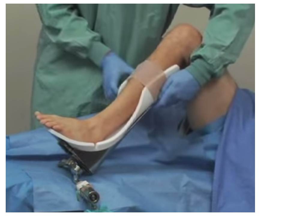 spider limb positioner